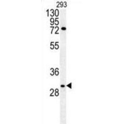 Claudin 12 (CLDN12) Antibody