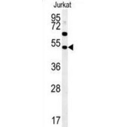 SAM Domain, SH3 Domain And Nuclear Localization Signals 1 (SAMSN1) Antibody