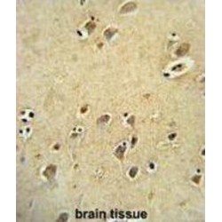 DIRAS Family GTPase 3 (DIRAS3) Antibody