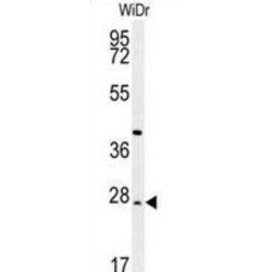 DIRAS Family GTPase 3 (DIRAS3) Antibody