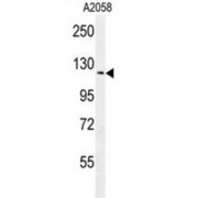 Nck-Associated Protein 3 (NCKAP1) Antibody