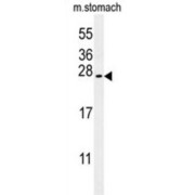 SERTA Domain-Containing Protein 3 (SRTD3) Antibody