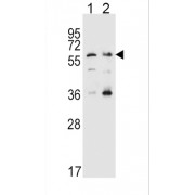 Solute Carrier Family 22 Member 4 (SLC22A4) Antibody