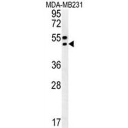 Translocating Chain-Associated Membrane Protein 2 (TRAM2) Antibody