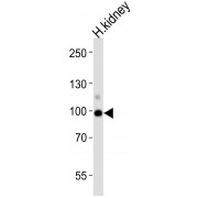 WB analysis of human kidney lysate, using ACE2 antibody (1/1000 dilution).