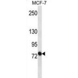 ATP Binding Cassette Subfamily B Member 10 (ABCB10) Antibody