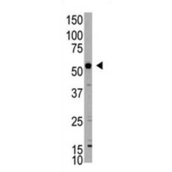 E3 Ubiquitin-Protein Ligase XIAP (XIAP) Antibody