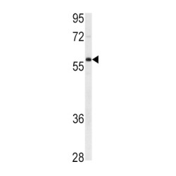 E3 Ubiquitin-Protein Ligase XIAP (XIAP) Antibody