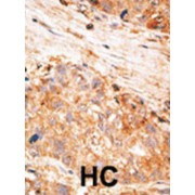 Baculoviral IAP Repeat Containing Protein 7 (BIRC7) Antibody