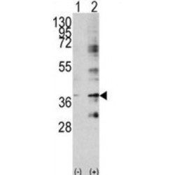 Baculoviral IAP Repeat Containing Protein 7 (BIRC7) Antibody