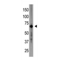 Cryptochrome 1 (CRY1) Antibody