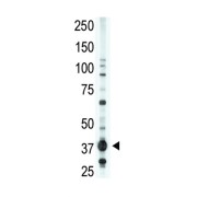 Lysophosphatidic Acid Receptor Edg-2 (EDG2) Antibody