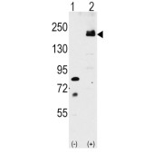 WB analysis of (1) non-transfected 293 cell lysates, and (2) 293 cell lysates transfected with the LRP6 gene.