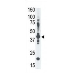 Melanoma-Associated Antigen 4 (MAGEA4) Antibody