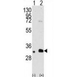 MAGE Family Member B2 (MAGEB2) Antibody