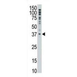 MAGE Family Member F1 (MAGEF1) Antibody