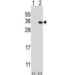 MAGE Family Member H1 (MAGEH1) Antibody