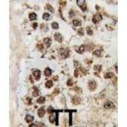 MLLT10, Histone Lysine Methyltransferase DOT1L Cofactor (MLLT10) Antibody