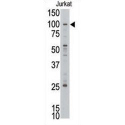 MLLT10, Histone Lysine Methyltransferase DOT1L Cofactor (MLLT10) Antibody