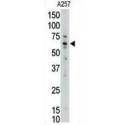 Protein ENL (MLLT1) Antibody