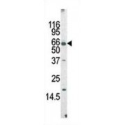 ALL1-Fused Gene From Chromosome 9 Protein (MLLT3) Antibody