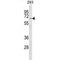 ALL1-Fused Gene From Chromosome 9 Protein (MLLT3) Antibody