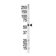 Protein AF-9 (MLLT3) Antibody