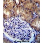 Forkhead Box Protein O4 (MLLT7) Antibody