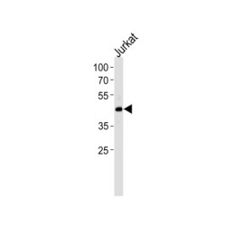 Forkhead Box Protein O4 (MLLT7) Antibody