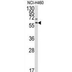 Matrix Metalloproteinase 17 (MMP17) Antibody