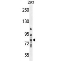 Matrix Metalloproteinase-9 (MMP9) Antibody