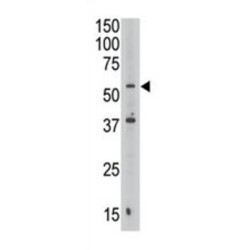 Septin 9 (SEPTIN9) Antibody