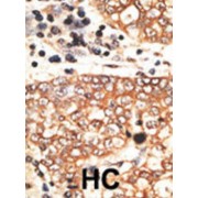 Neuregulin 2 (NRG2) Antibody