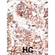 Neuregulin 3 (NRG3) Antibody