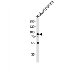 Neuregulin 3 (NRG3) Antibody