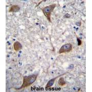 Neuregulin 3 (NRG3) Antibody