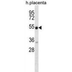 Neuregulin 3 (NRG3) Antibody