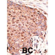 Retinoic Acid-Induced Protein 17 (RAI17) Antibody