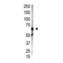 Retinoic Acid-Induced Protein 17 (RAI17) Antibody