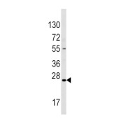 Sclerostin (SOST) Antibody