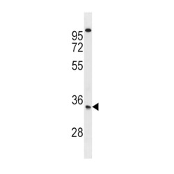 Sclerostin (SOST) Antibody