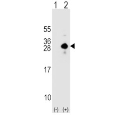 Sclerostin (SOST) Antibody