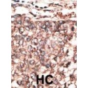 Spinal Cord-Derived Growth Factor B (SCDGFB) Antibody