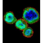 Retinoblastoma Protein 1 (RB1) Antibody