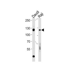 Retinoblastoma Protein 1 (RB1) Antibody