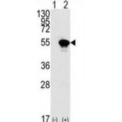 Cellular Tumor Antigen P53 (p53) Antibody