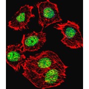 Cellular Tumor Antigen P53 (p53) Antibody