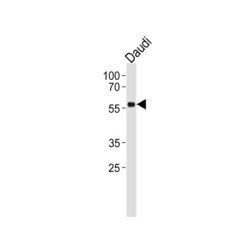 Cellular Tumor Antigen P53 (p53) Antibody