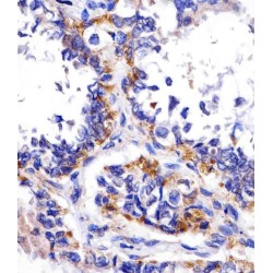 DNA Damage Inducible Transcript 4 (DDIT4) Antibody