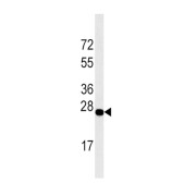 Western blot analysis of DDIT4 Antibody in Jurkat cell line lysates (35 µg/lane).